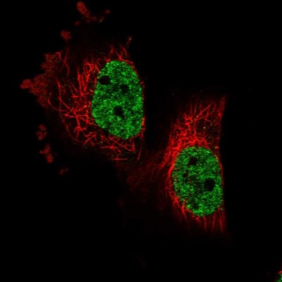 Immunocytochemistry/Immunofluorescence: C12orf48 Antibody [NBP1-93969] - Immunofluorescent staining of human cell line U-251 MG shows localization to nucleoplasm.