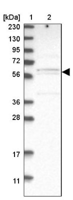 Western Blot: C17orf53 Antibody [NBP1-93494] - Lane 1: Marker  [kDa] 230, 130, 95, 72, 56, 36, 28, 17, 11.  Lane 2: Human cell line RT-72