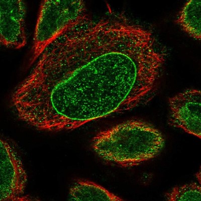 Immunocytochemistry/Immunofluorescence: Neuferricin Antibody [NBP1-93489] - Immunofluorescent staining of human cell line U-2 OS shows localization to nuclear membrane.