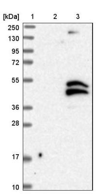 Western Blot: C21orf91 Antibody [NBP1-88280] - Lane 1: Marker [kDa] 250, 130, 95, 72, 55, 36, 28, 17, 10. Lane 2: Negative control (vector only transfected HEK293T lysate). Lane 3: Over-expression lysate (Co-expressed with a C-terminal myc-DDK tag (3.1 kDa) in mammalian HEK293T cells).