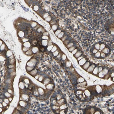 Immunohistochemistry-Paraffin: C21orf91 Antibody [NBP1-88280] - Staining of human small intestine shows strong cytoplasmic positivity in glandular cells.