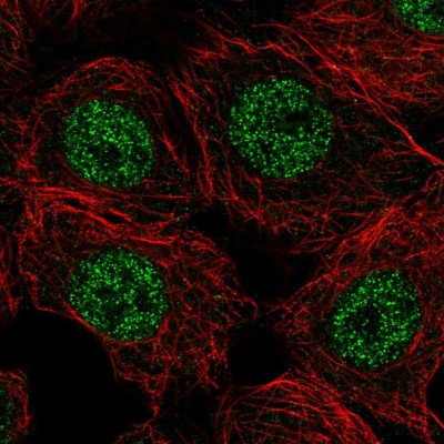 Immunocytochemistry/Immunofluorescence: Calpain 15 Antibody [NBP1-88197] - Immunofluorescent staining of human cell line MCF7 shows localization to nucleoplasm.