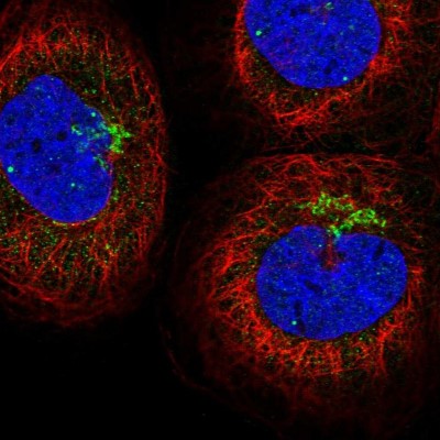 Immunocytochemistry/Immunofluorescence: LHFPL4 Antibody [NBP1-86225] - Staining  of human cell line A-431 shows positivity in golgi apparatus.