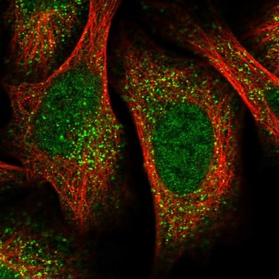 Immunocytochemistry/Immunofluorescence: UBR1 Antibody [NBP1-86253] - Immunofluorescent staining of human cell line U-2 OS shows localization to nucleoplasm & vesicles.