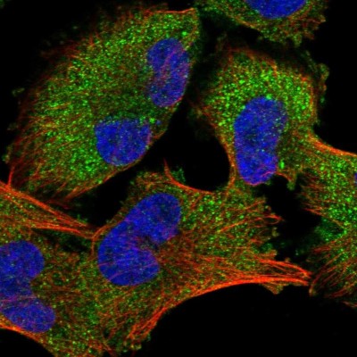 Immunocytochemistry/Immunofluorescence: DMRT2 Antibody [NBP1-86361] - Staining  of human cell line U-251MG shows positivity in cytoplasm.