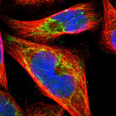 Immunocytochemistry/Immunofluorescence: OXA1L Antibody [NBP1-81209] - Immunofluorescent staining of human cell line A-431 shows localization to mitochondria.