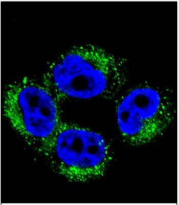 Immunocytochemistry/Immunofluorescence: AP1M1 Antibody [NBP2-30032] - (Center)(NBP2-30032) with A375 cell followed by Alexa Fluor 488-conjugated goat anti-rabbit lgG (green). DAPI was used to stain the cell nuclear (blue).