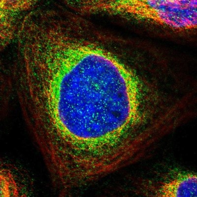 Immunocytochemistry/Immunofluorescence: PPM1D Antibody [NBP1-87249] - Immunofluorescent staining of human cell line A-431 shows localization to endoplasmic reticulum.