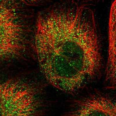 Immunocytochemistry/Immunofluorescence: CEP89 Antibody [NBP2-38446] - Immunofluorescent staining of human cell line A-431 shows localization to cytosol.