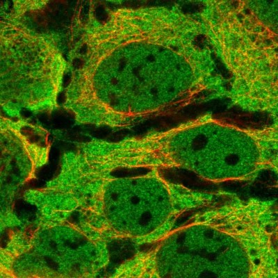 Immunocytochemistry/Immunofluorescence: SAPS3 Antibody [NBP2-34048] - Immunofluorescent staining of human cell line CACO-2 shows localization to nucleoplasm, plasma membrane & cytosol.
