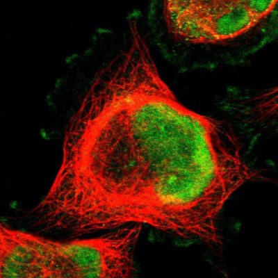 Immunocytochemistry/Immunofluorescence: MLF2 Antibody [NBP1-82519] - Immunofluorescent staining of human cell line U-251 MG shows localization to nucleoplasm & plasma membrane.