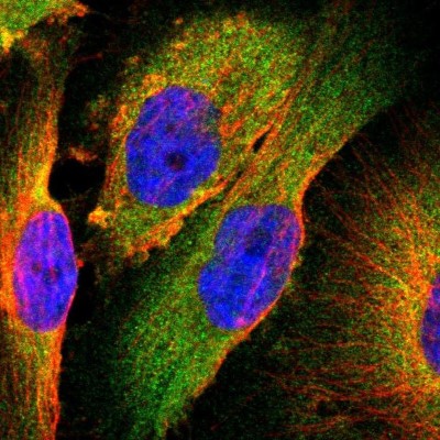 Immunocytochemistry/Immunofluorescence: TSC22D2 Antibody [NBP1-81491] - Staining of human cell line U-251 MG shows localization to cytosol.