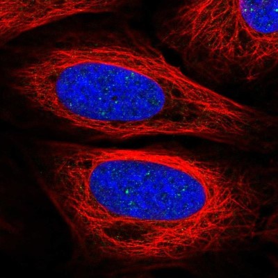 Immunocytochemistry/Immunofluorescence: SAP25 Antibody [NBP2-32365] - Staining of human cell line U-2 OS shows localization to nuclear bodies.
