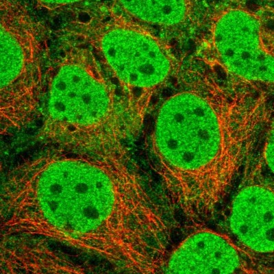 Immunocytochemistry/Immunofluorescence: SRA1 Antibody [NBP2-47260] - Immunofluorescent staining of human cell line CACO-2 shows localization to nucleoplasm & cytosol.