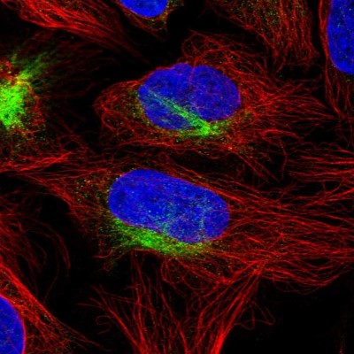 Immunocytochemistry/Immunofluorescence: Apc4 Antibody [NBP1-90138] - Staining of human cell line U-2 OS shows positivity in cytoskeleton (intermediate filaments).