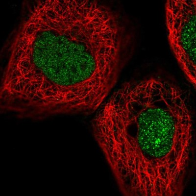 Immunocytochemistry/Immunofluorescence: Myoneurin Antibody [NBP1-92157] - Immunofluorescent staining of human cell line A-431 shows localization to nucleus.