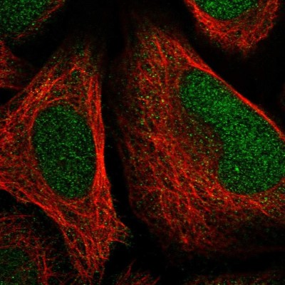 Immunocytochemistry/Immunofluorescence: FAM204A Antibody [NBP1-90035] - Immunofluorescent staining of human cell line U-2 OS shows localization to nucleus & nucleoli.