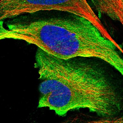 Immunocytochemistry/Immunofluorescence: HYLS1 Antibody [NBP1-83513] - Immunofluorescent staining of human cell line U-2 OS shows localization to plasma membrane & cytosol.