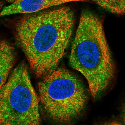 Immunocytochemistry/Immunofluorescence: TSPYL5 Antibody [NBP1-93578] - Immunofluorescent staining of human cell line A549 shows localization to cytosol & the Golgi apparatus.
