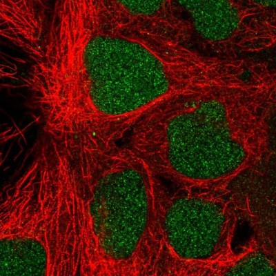 Immunocytochemistry/Immunofluorescence: PROSER1 Antibody [NBP2-37949] - Staining  of human cell line CACO-2 shows positivity in nucleus.