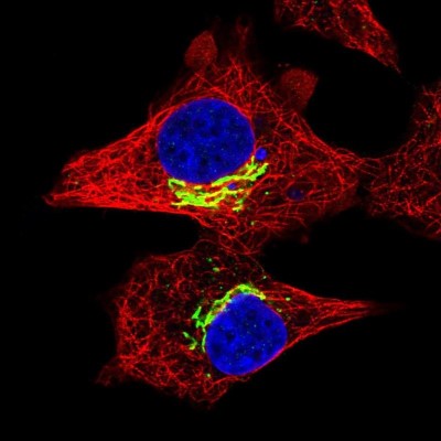 Immunocytochemistry/Immunofluorescence: RFK Antibody [NBP2-37962] - Immunofluorescent staining of human cell line A549 shows localization to the Golgi apparatus.