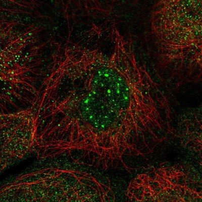 Immunocytochemistry/Immunofluorescence: Nocturnin Antibody [NBP2-37939] - Staining of human cell line A-431 shows localization to nuclear bodies & cytosol.
