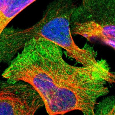 Immunocytochemistry/Immunofluorescence: GRAMD1A Antibody [NBP1-93729] - Immunofluorescent staining of human cell line U-2 OS shows localization to plasma membrane & cytosol.