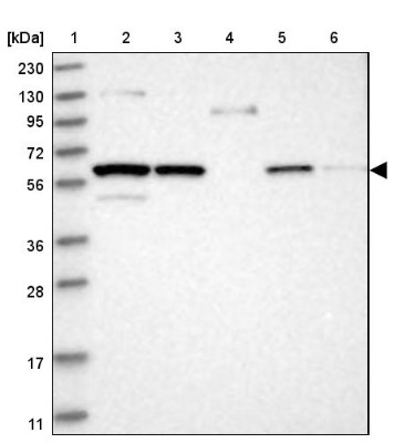 Western Blot: C13orf18 Antibody [NBP1-82141] - Lane 1: Marker  [kDa] 230, 130, 95, 72, 56, 36, 28, 17, 11.  Lane 2: Human cell line RT-4.  Lane 3: Human cell line U-251MG sp.  Lane 4: Human plasma (IgG/HSA depleted).  Lane 5: Human liver tissue.  Lane 6: Human tonsil tissue
