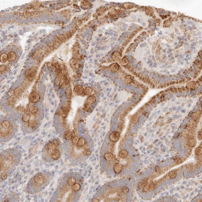 Immunohistochemistry-Paraffin: C13orf18 Antibody [NBP1-82141] - Staining of human duodenum shows moderate cytoplasmic positivity in glandular cells.