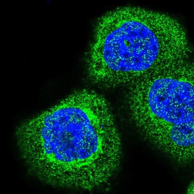 Immunocytochemistry/Immunofluorescence: COMTD1 Antibody [NBP1-82065] - Immunofluorescent staining of human cell line A-431 shows localization to plasma membrane, cytosol & the Golgi apparatus.