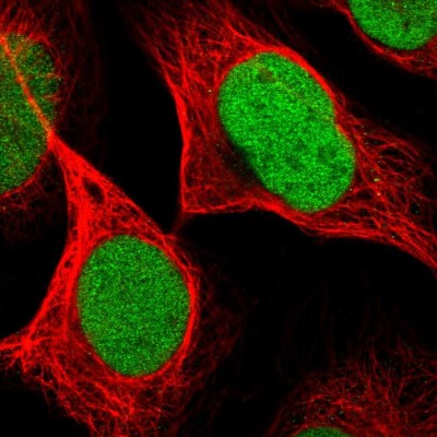 Immunocytochemistry/Immunofluorescence: C17orf66 Antibody [NBP1-81985] - Staining of human cell line U-2 OS shows positivity in nuclei.