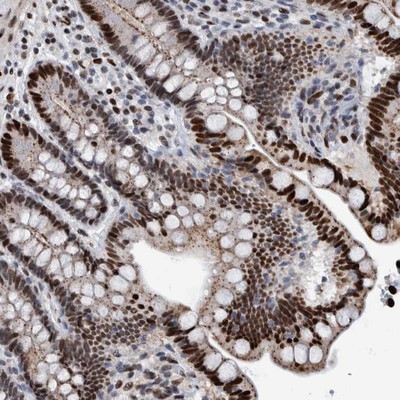 Immunohistochemistry-Paraffin: C17orf66 Antibody [NBP1-81985] - Staining of human colon shows strong nuclear positivity in glandular cells.