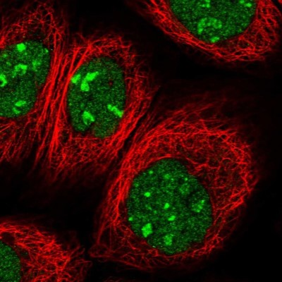 Immunocytochemistry/Immunofluorescence: PTMS Antibody [NBP1-80948] - Immunofluorescent staining of human cell line A-431 shows localization to nucleus & nucleoli.