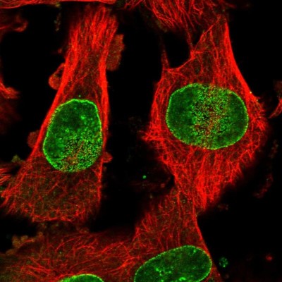 Immunocytochemistry/Immunofluorescence: Nup153 Antibody [NBP1-81724] - Immunofluorescent staining of human cell line U-251 MG shows localization to nuclear membrane.