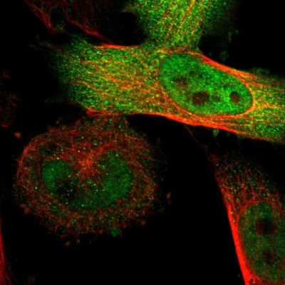 Immunocytochemistry/Immunofluorescence: SGSM2 Antibody [NBP1-93637] - Staining of human cell line U-251 MG shows localization to nucleoplasm & cytosol.