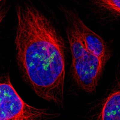 Immunocytochemistry/Immunofluorescence: URB2 Antibody [NBP1-93655] - Immunofluorescent staining of human cell line U-2 OS shows localization to nucleoli.