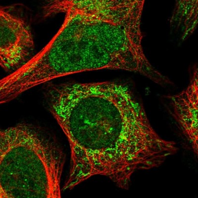 Immunocytochemistry/Immunofluorescence: ANKRD52 Antibody [NBP1-93844] - Immunofluorescent staining of human cell line U-2 OS shows localization to nucleoplasm & mitochondria.