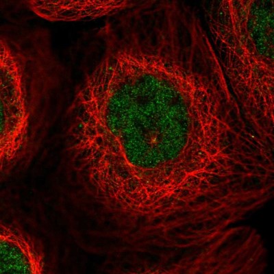 Immunocytochemistry/Immunofluorescence: CCDC19 Antibody [NBP1-91757] - Immunofluorescent staining of human cell line A-431 shows localization to nucleoplasm.