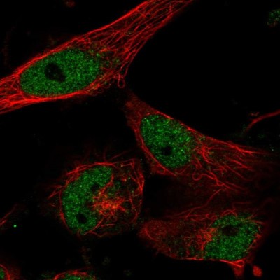 Immunocytochemistry/Immunofluorescence: CLCN7 Antibody [NBP1-91792] - Immunofluorescent staining of human cell line U-251 MG shows localization to nucleoplasm.