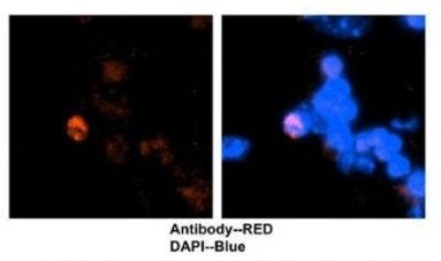 Immunocytochemistry/Immunofluorescence: CDT1 Antibody [NBP1-58114] - Mouse brain stem cells, 2 ug/ml.