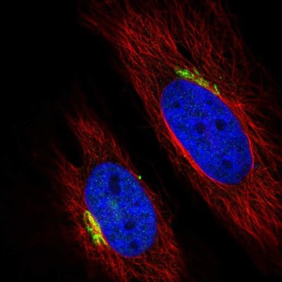 Immunocytochemistry/Immunofluorescence: beta-1,4-Galactosyltransferase 1/B4GalT1 Antibody [NBP1-88655] - Staining of human cell line HeLa shows localization to the Golgi apparatus.