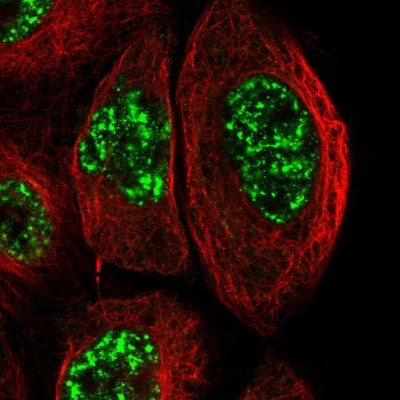 Immunocytochemistry/Immunofluorescence: TEM Antibody [NBP1-89939] - Staining of human cell line A-431 shows positivity in nucleus but not nucleoli.