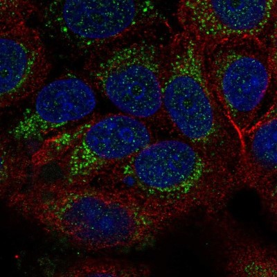 Immunocytochemistry/Immunofluorescence: TID1 Antibody [NBP2-34066] - Immunofluorescent staining of human cell line MCF7 shows localization to mitochondria.
