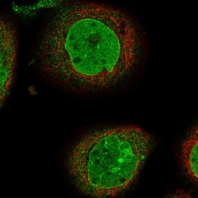 Immunocytochemistry/Immunofluorescence: PHF20 Antibody [NBP1-88309] - Immunofluorescent staining of human cell line A-431 shows localization to nucleoplasm & nuclear membrane.