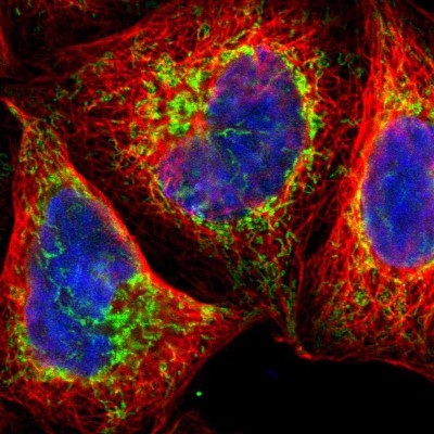 Immunocytochemistry/Immunofluorescence: TOP1MT Antibody [NBP1-89473] - Immunofluorescent staining of human cell line A-431 shows localization to mitochondria.