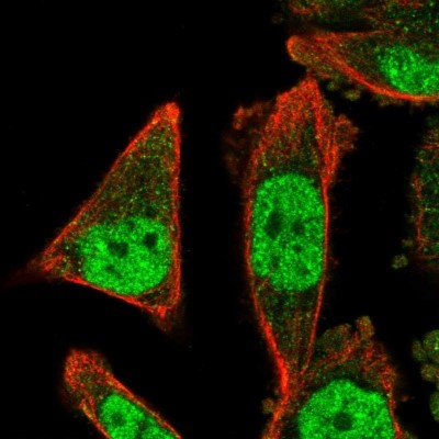 Immunocytochemistry/Immunofluorescence: ZNF414 Antibody [NBP2-33693] - Staining of human cell line PC-3 shows localization to nucleoplasm & cytosol.