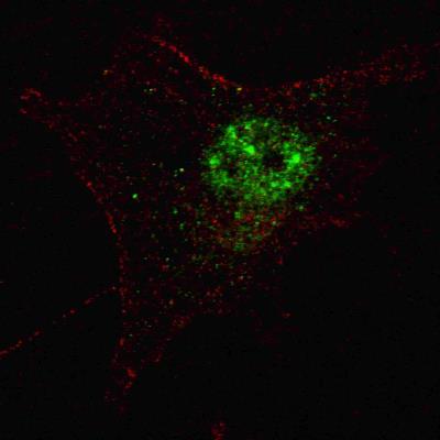 Immunocytochemistry/Immunofluorescence: PDHX Antibody [NBP2-30053] - SY5Y cells stained with PDX1 (T11) antibody. SY5Y cells were fixed with 4% PFA (20 min), permeabilized with Triton X-100 (0.2%, 30 min). Cells were then incubated with NBP2-30053 PDX1 (T11) primary antibody (1:100, 2 h at room temperature). For secondary antibody, Alexa Fluor 488 conjugated donkey anti-rabbit antibody (green) was used (1:1000, 1h). Nuclei were counterstained with Hoechst 33342 (blue) (10 ug/ml, 5 min). Note the highly specific localization of the PDX1 immunosignal to the nucleus, supported by Human Protein Atlas Data (//www.proteinatlas.org/ENSG00000110435).