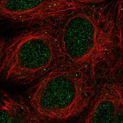 Immunocytochemistry/Immunofluorescence: GLB1L2 Antibody [NBP2-31804] - Immunofluorescent staining of human cell line HEK 293 shows localization to nucleus & vesicles.