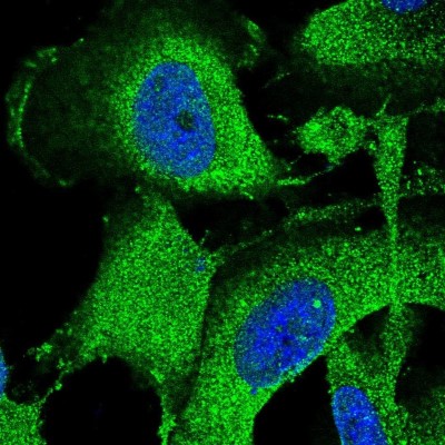 Immunocytochemistry/Immunofluorescence: SPG11 Antibody [NBP1-82143] - Immunofluorescent staining of human cell line U-251 MG shows localization to plasma membrane & cytosol.