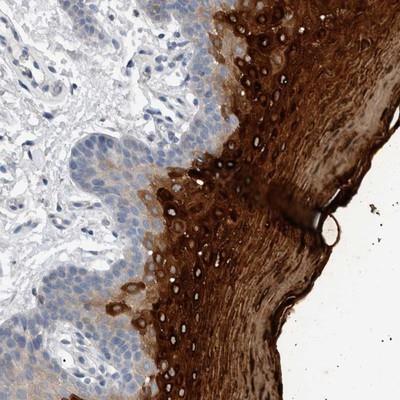Immunohistochemistry: Cornulin Antibody [NBP1-88479] - Staining of human oral mucosa shows strong cytoplasmic positivity in squamous epithelial cells.